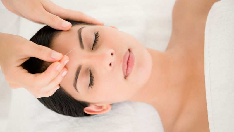 Facial Acupuncture tcm With No Side Effects